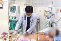 Sưng cẳng chân, đau bụng người bệnh nguy kịch vì hội chứng ly giải cơ vân