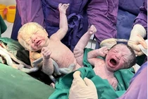 Cứu mẹ, bảo tồn hai thai nhi trong ca bệnh nguy cơ cao