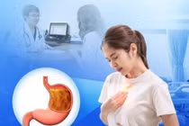 Trào ngược dạ dày thực quản có thể tiến triển ung thư