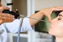 Tưởng nghẹt mũi do thời tiết không ngờ lệch vách ngăn, biến chứng nhỏ thuốc