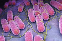 Tiêu chảy, sốt cao người đàn ông sốc nhiễm khuẩn nguy kịch do thương hàn