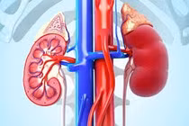 Viêm cầu thận có di truyền không?