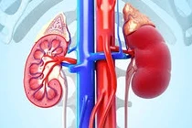 Viêm cầu thận có di truyền không?