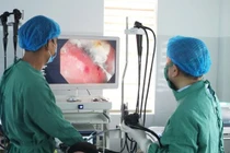 Trẻ nuốt phải nam châm dễ thủng ruột