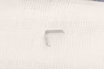 Bé 12 tháng tuổi hóc ghim tất vào họng, cảnh báo nguy cơ dị vật sắc nhọn