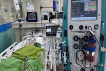 Đau bụng lúc nửa đêm, người đàn ông vỡ phình động mạch chủ bụng nguy kịch