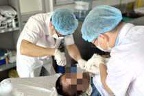 Không chạm vào điện người đàn ông vẫn bỏng nặng do tia hồ quang