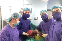 Đau âm ỉ lưng, nang thận… dễ mắc ung thư
