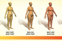 Biết chỉ số eo hông cho cơ thể khỏe mạnh, phòng ngừa tim mạch, đột quỵ
