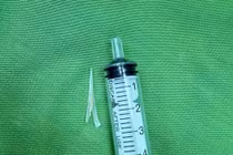 Nuốt đau, ứ đọng nước bọt, phát hiện xương cá 2 chạc sắc nhọn trong thực quản