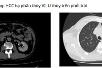 Vượt 1000 km người đàn ông Campuchia đến Việt Nam tìm thấy hy vọng sống