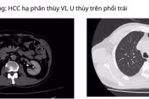 Vượt 1000 km người đàn ông Campuchia đến Việt Nam tìm thấy hy vọng sống