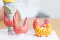 Rò dưỡng chấp sau mổ tuyến giáp gây ảnh hưởng nghiêm trọng