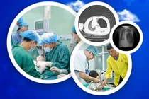 Ngã tại nhà, trẻ bị tràn máu, tràn khí màng phổi nguy kịch