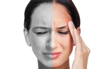 Động kinh, đột quỵ... vì bệnh đau đầu migraine