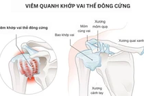 Bệnh viện, phòng khám chẩn đoán tốt bệnh đau vai gáy