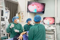 Hai người thoát đại phẫu nhờ tầm soát sớm tổn thương dạ dày
