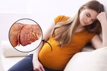 Cuộc chạy đua với tử thần cứu sản phụ hôn mê sau sinh