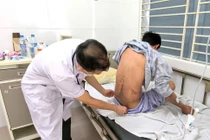 Người thợ sắt bị sốc phản vệ độ 3 vì silicon chống dột