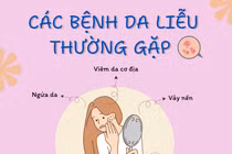 Tự mua thuốc điều trị da liễu dễ biến chứng kéo dài