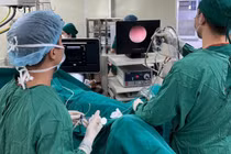 Giải cứu sỏi niệu quản ở 'nút thắt cổ chai'