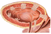 Địa chỉ vàng: Các bệnh viện điều trị tốt ung thư bàng quang
