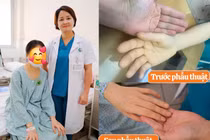 Chủ quan với u xơ tử cung, bệnh nhân 43 tuổi thiếu máu nặng đe dọa tính mạng