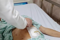 Dùng dạ dày tạo hình thực quản teo cho người đàn ông uống nhầm nước tro tàu