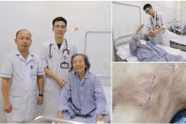 Cụ bà 95 tuổi đột quỵ não được cứu sống nhờ máy tạo nhịp tim