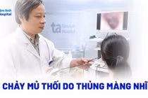 Tai chảy mủ thối do thủng màng nhĩ chủ quan không tái khám
