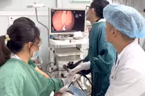 Cắn gãy thìa khi ăn sữa chua, bé 20 tháng tuổi suýt thủng dạ dày