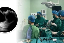 Lấy u nang ống Muller bẩm sinh hiếm gặp bảo tồn sinh sản cho phụ nữ 28 tuổi