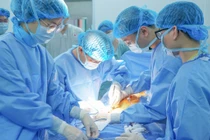 Công nghệ 3D mổ thay van tim xuyên qua thành ngực với trocars nhỏ ≤ 1,2cm