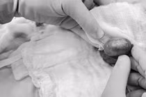 Chạy đua với 'giờ vàng' bảo tồn thành công tinh hoàn cho chàng trai 20 tuổi