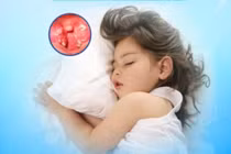 Trẻ ngưng thở khi ngủ ngáy, cha mẹ không nên chủ quan