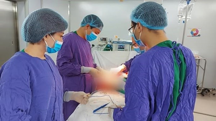 Các bác sĩ làm chủ kỹ thuật phẫu thuật tái tạo thực quản bằng đại tràng cho bệnh nhân có tiền sử can thiệp vùng ngực – bụng/Ảnh Bệnh viện Ung bướu Hà Nội 1-3333.jpg