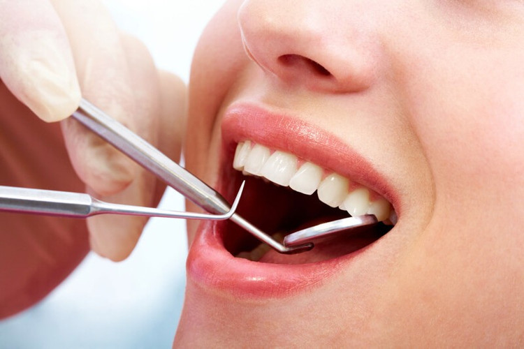 Răng mọc lạc chỗ là những răng không nằm đúng vị trí của chúng trên cung hàm mà mọc ở những chỗ khác. Răng mọc lạc chỗ là những răng không nằm đúng vị trí của chúng trên cung hàm mà mọc ở những chỗ khác.