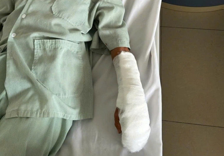 Các y bác sĩ đã phẫu thuật cấp cứu thành công cho nữ bệnh nhân/Ảnh Trung tâm Y tế Hải Hà 2.jpg