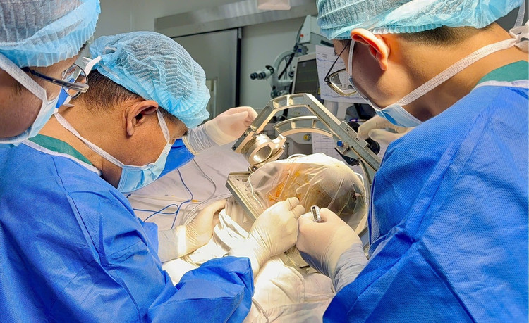 Sau khi đặt điện cực não sâu, phẫu thuật loại bỏ ổ sinh động kinh, bệnh nhân đang bình phục tốt. Ảnh tienphong.vn Sau khi đặt điện cực não sâu, phẫu thuật loại bỏ ổ sinh động kinh, bệnh nhân đang bình phục tốt. Ảnh tienphong.vn