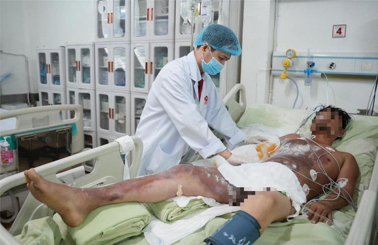 Bệnh nhân C.P. bị bỏng nặng vùng ngực, bụng, tay và chân bên phải, kèm theo yếu tay chân bên phải và chèn ép khoang tay phải...Ảnh BV Bệnh nhân C.P. bị bỏng nặng vùng ngực, bụng, tay và chân bên phải, kèm theo yếu tay chân bên phải và chèn ép khoang tay phải...Ảnh BV