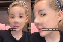 Ngân 98 bày tỏ thái độ sau nghi vấn phẫu thuật thẩm mỹ hỏng