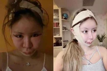 Chi 14 tỷ cho 200 ca PTTM, cô gái hối hận nhìn lại quá khứ