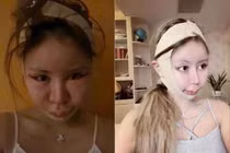 Chi 14 tỷ cho 200 ca PTTM, cô gái hối hận nhìn lại quá khứ