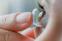 Cô gái bị gà mổ vào mắt khi nằm lên ghế sofa chụp ảnh tự sướng