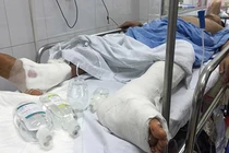 Bộ Y tế chấn chỉnh hoạt động phẫu thuật sau nhiều vụ mổ nhầm