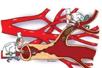 Những con số kinh khủng về bệnh cao huyết áp