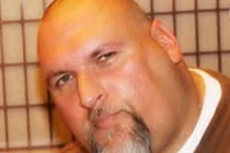 Quý ông phải cắt cụt chân do vi khuẩn ăn thịt người