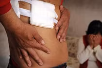 Kinh hãi phát hiện mất thận sau ca phẫu thuật ngực