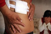 Kinh hãi phát hiện mất thận sau ca phẫu thuật ngực