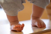 Nguyên nhân bất ngờ khiến trẻ bị biến dạng xương